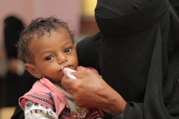 الأمم المتحدة تحذر من وفاة مئات آلاف الأطفال في اليمن