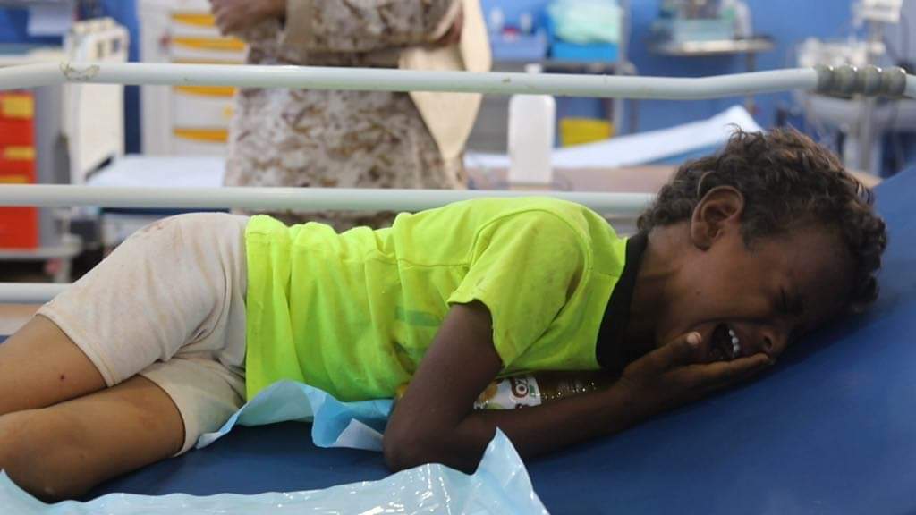 إصابة طفلين في قصف لمليشيا الحوثي جنوب الحديدة