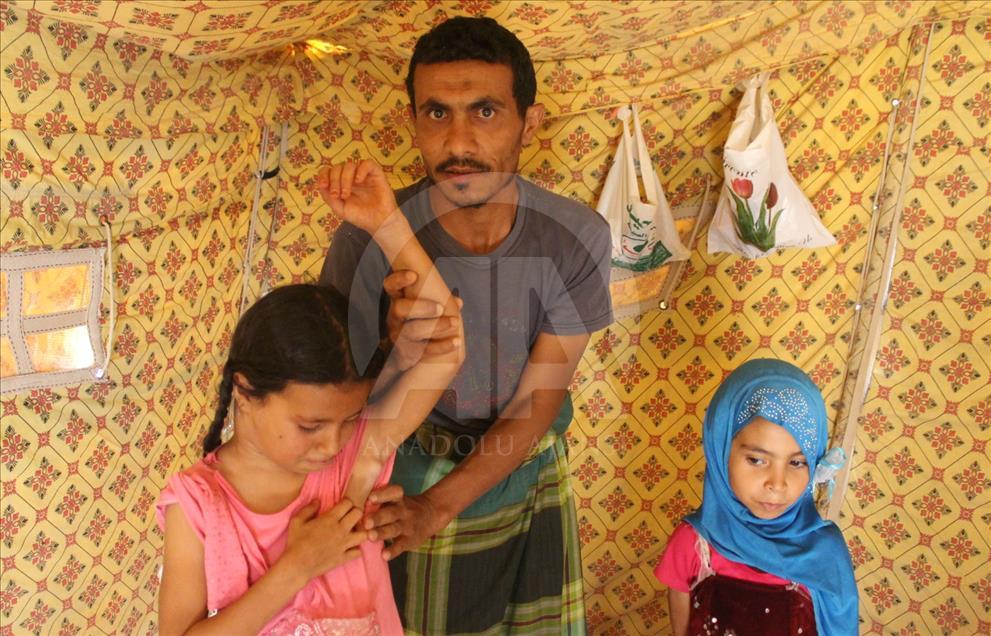 أسرة يمنية.. فرت من ويلات الحرب فلاحق السرطان ابنتها