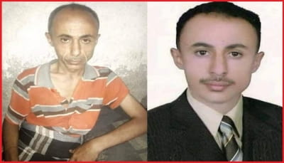 خروج صحفي من سجون الحوثي في وضع صحي سيء جراء تعرضه للتعذيب